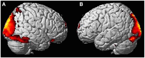 Scientists Scanned A Woman's Brain During An Out-Of-Body Experience — And What They Found Was Amazing
